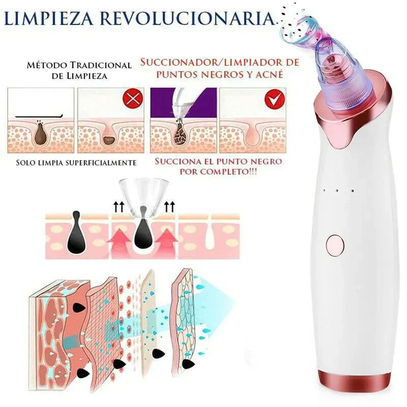 🔥DermaVac™ – Eliminación Profunda de Puntos Negros